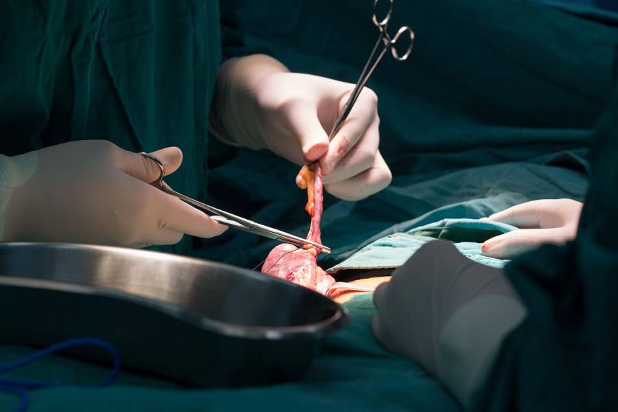 Appendix Treatment in Pune