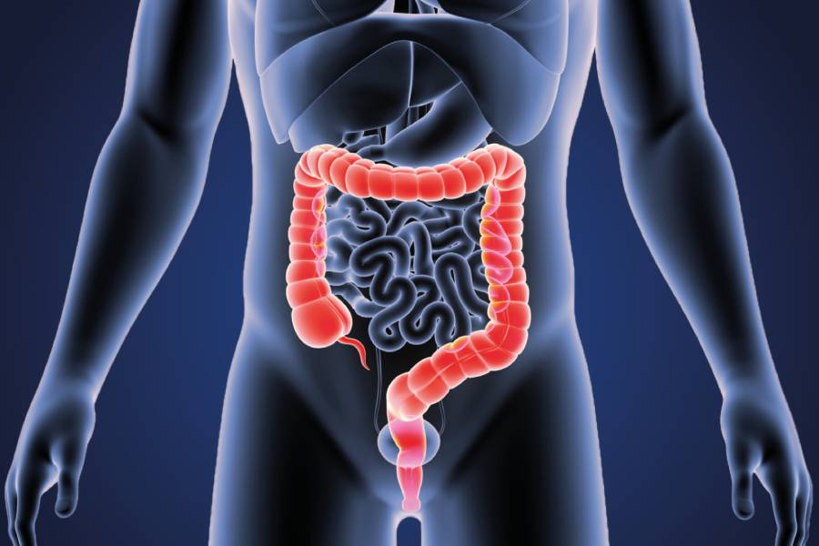Colorectal Cancer Specialist in Pune