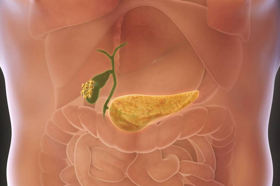 Gall Bladder Cancer Treatment