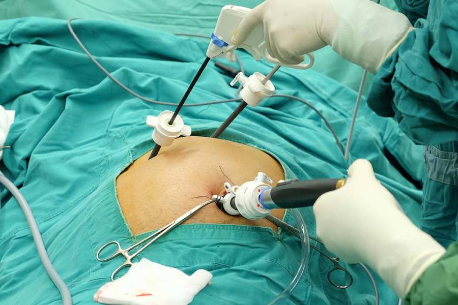 Gallbladder Removal Surgery in Pune