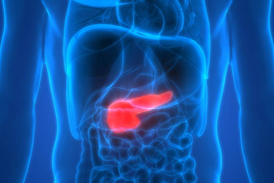 Pancreatic Cancer Treatment