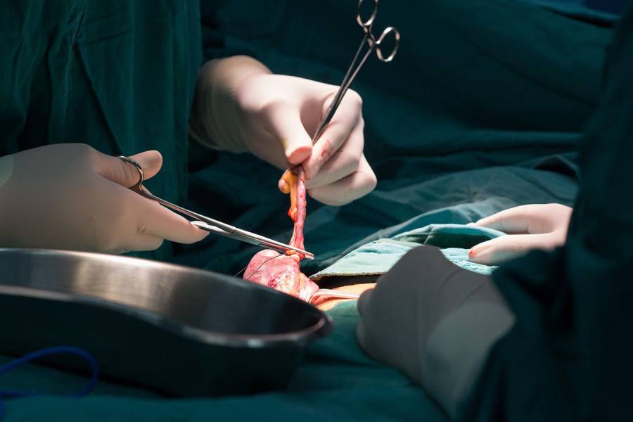 Appendix Removal Surgery in Pune