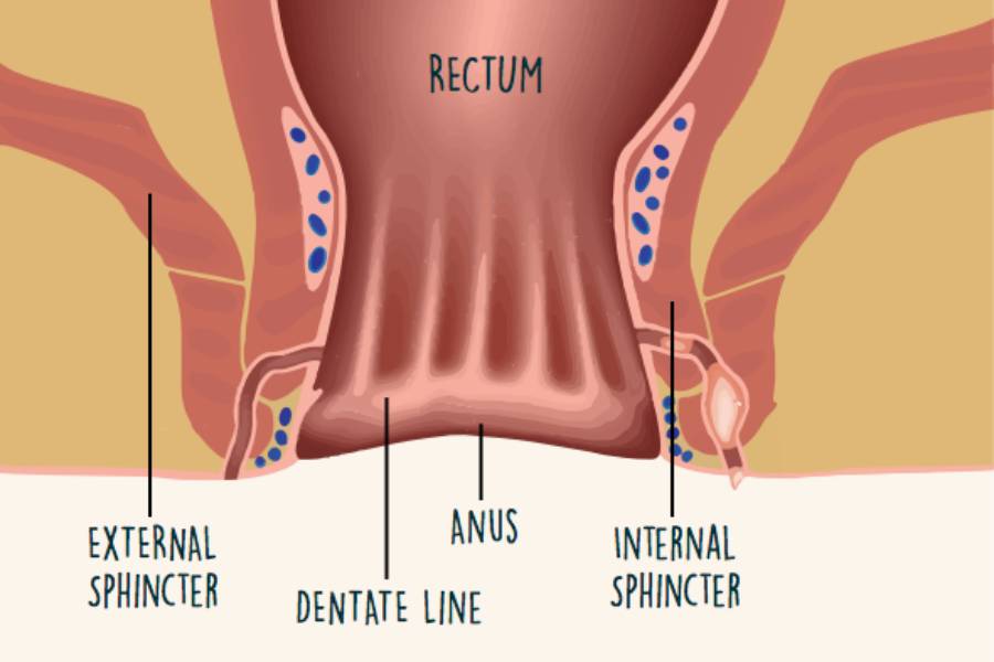 Fistula Specialist in Pune