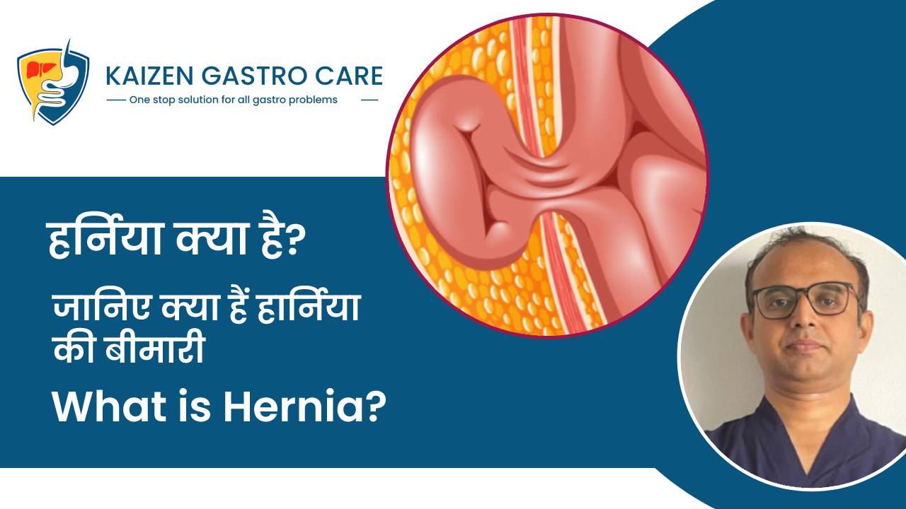 Hernia Surgery in Pune | Best Hernia Specialist in Pune: Kaizen Gastro Care
