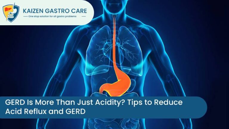 Tips to Reduce Acid Reflux And GERD- Kaizen Gastro Care