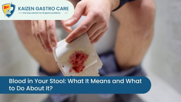 Blood In Your Stool: Causes & Care | Kaizen Gastro Care