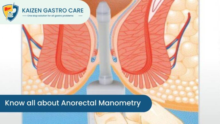 Know all about Anorectal Manometry | Kaizen Gastro Care