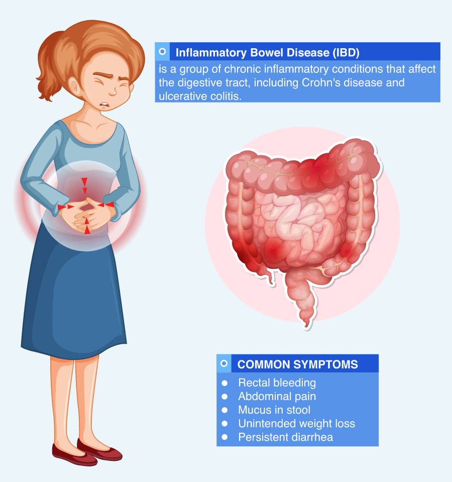 Diet For IBS/ IBD