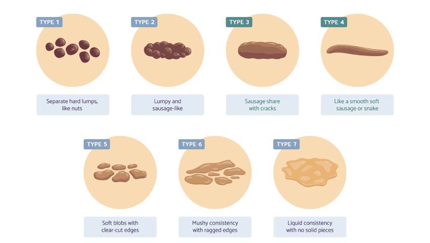 Stool Chart- Kaizen Gastro Care