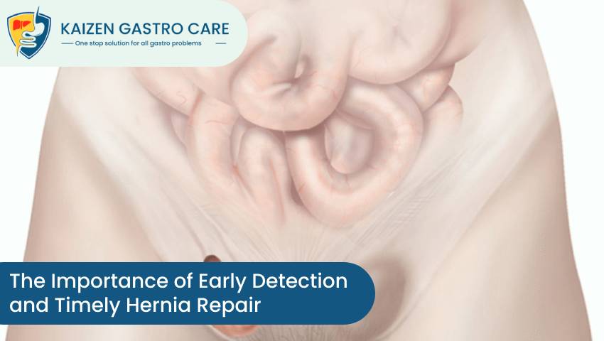 The Importance of Early Detection and Timely Hernia Repair- Kaizen Gastro  Care