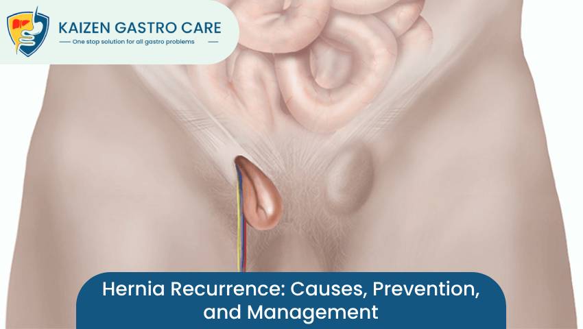 Hernia Recurrence