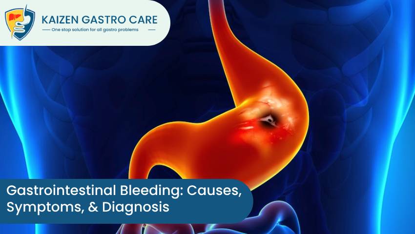 Gastrointestinal Bleeding