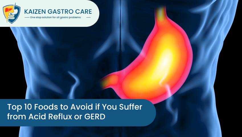 Top 10 Foods to Avoid if You Suffer from Acid Reflux or GERD