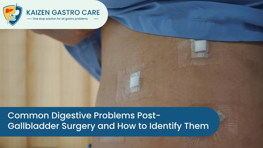 Common Digestive Problems Post-Gallbladder Surgery and How to Identify Them