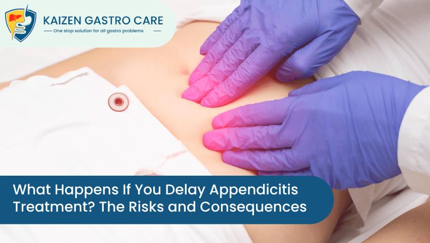 What Happens If You Delay Appendicitis Treatment? The Risks and Consequences