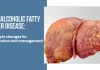 Non-Alcoholic Fatty Liver Disease (NAFLD): Lifestyle changes for prevention and management