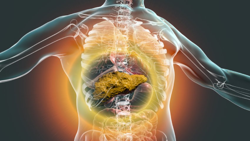 3D illustration showing liver cirrhosis inside the human body, highlighting liver damage and scarring