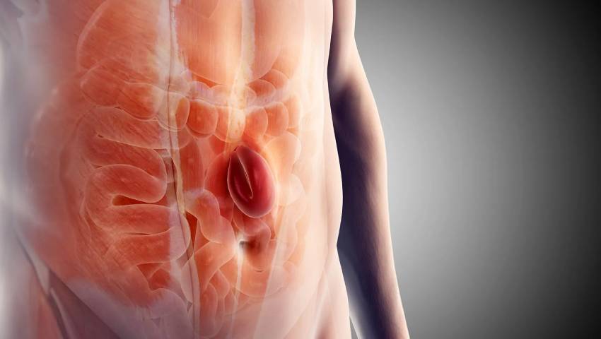 Visible abdominal hernia showing bulge near the abdomen