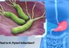H. Pylori infection bacteria affecting stomach lining – Kaizen Gastro Care Pune