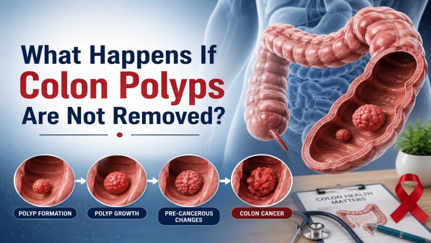 What Happens If Colon Polyps Are Not Removed? Expert Colon Polyps Treatment at Kaizen Gastro Care.