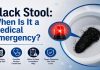 Black stool and possible digestive bleeding