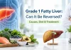 Grade 1 fatty liver diet and treatment guide